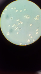 Saccharomyces cerevisiae