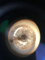 Glyphyalinia