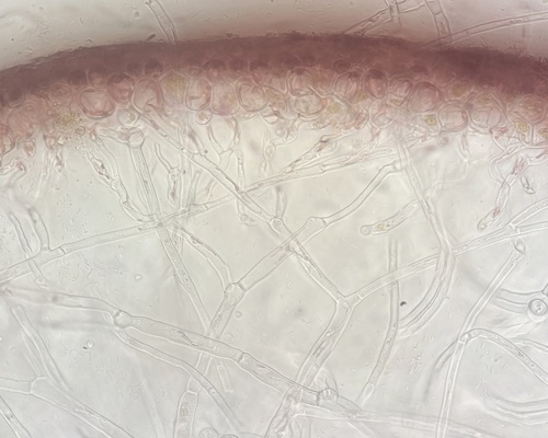 Tricleocarpa cylindrica