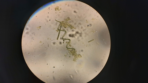Arthrospira platensis observed 2019-12-11