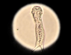 Gastrotricha