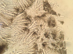 Durella macrospora