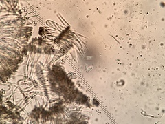 Durella macrospora
