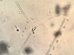 Lemonniera alabamensis