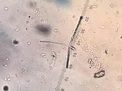 Lemonniera pseudofloscula