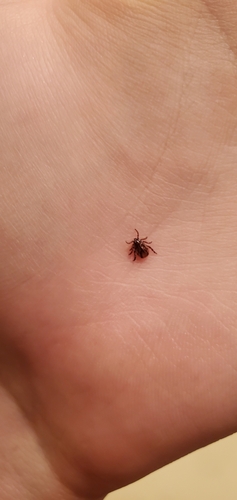 Winter tick photo 2