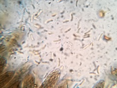 Cryptovalsa prominens