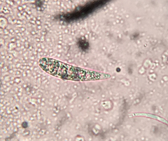 Patellaria atrata