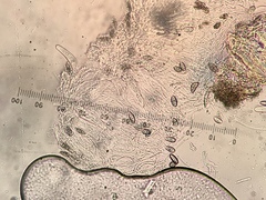 Setomelanomma holmii