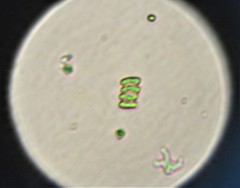 Scenedesmaceae