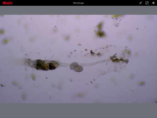 Collotheca coronetta