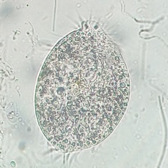 Spirotrichea