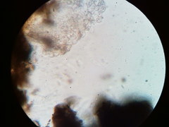 Diatrype decorticata