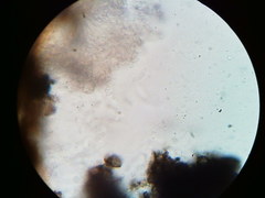 Diatrype decorticata