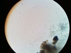 Diatrype decorticata