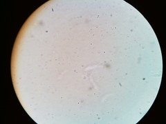 Diatrype decorticata