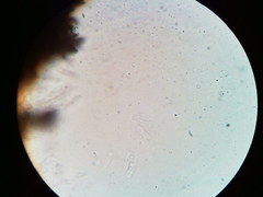 Diatrype decorticata