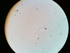 Diatrype decorticata