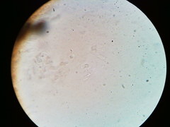 Diatrype decorticata