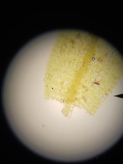 Ptychostomum imbricatulum