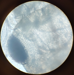 Lepinotus patruelis