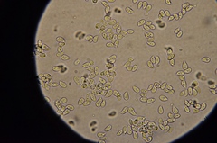Arrhenia acerosa