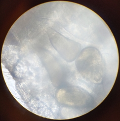 Lachesilla pedicularia