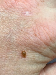 Adoxellus flavihirtus