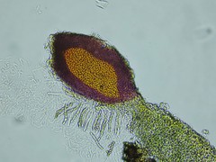 Xenonectriella leptaleoides