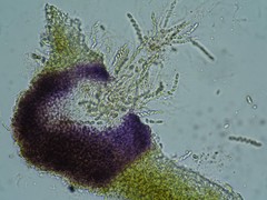 Xenonectriella leptaleoides