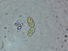 Xenonectriella leptaleoides