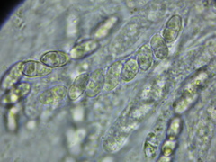 Xenonectriella leptaleoides