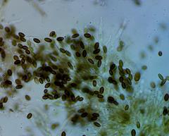 Mycocalicium subtile