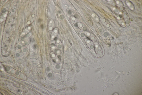 Representative image of Octospora musci-muralis