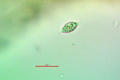 Fuscopannaria leucosticta