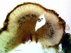 Fuscopannaria leucosticta