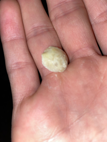 Anomia ephippium