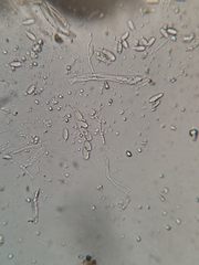 Cercidospora caudata