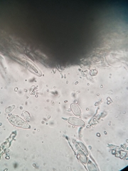 Cercidospora caudata