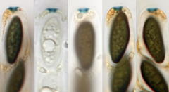 Anthostomella lugubris