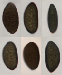 Anthostomella lugubris