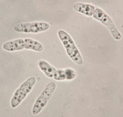 Calycina scolochloae