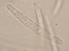 Calonectria pyrochroa