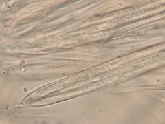 Coccomyces delta