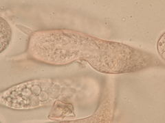 Cyphella ferruginea