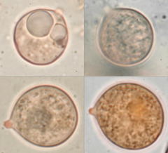 Cyphella ferruginea