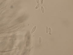 Dematioscypha olivacea