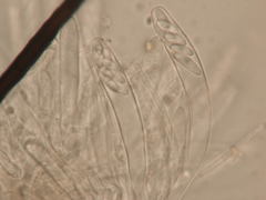 Dematioscypha olivacea