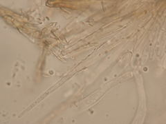 Dematioscypha olivacea