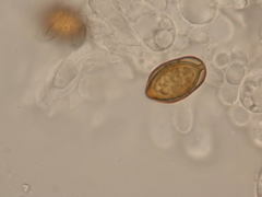 Descomyces albus